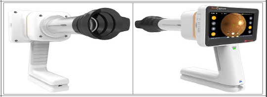 조달청의 '혁신시제품 시범구매사업'으로 선정된 '휴대용 안저 카메라'로, 지자체나 의료기관 등이 수요기관으로 예상된다.  조달청 제공